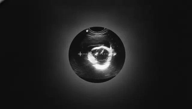 Sonogram Ultrasound BW look sample - Scientific Imaging - contemporary